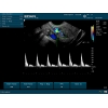 EDAN ECHOGRAPHE U50 AVEC 1 SONDE