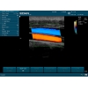 EDAN ECHOGRAPHE U50 AVEC 3 SONDES