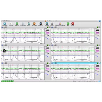 EDAN LOGICIEL TRANSFERT DE DONNEES - MFM CNS LITE POUR F3