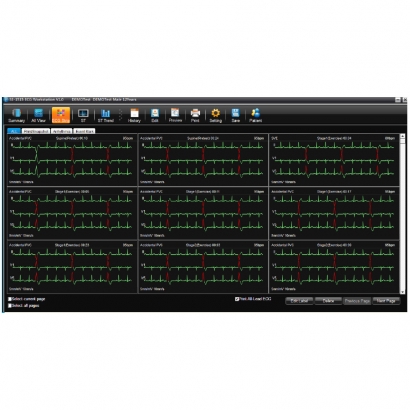 EDAN LOGICIEL SE-1515 - GESTION DE DONNEES PATIENT POUR ECG