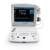 EDAN ECHOGRAPHE DUS60 +SONDE TRANSVAGINALE E611-2