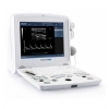 EDAN ECHOGRAPHE DUS60 +SONDE TRANSVAGINALE E611-2