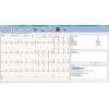 EDAN ECG PC SE-1010