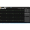 EDAN ECG PC SE-1515 DE15