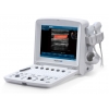 EDAN ECHOGRAPHE PORTABLE U50