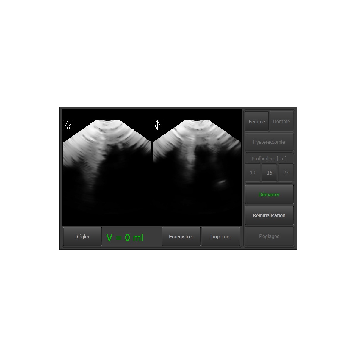 Scanner vésical, Scanner vésical à ultrasons - Tous les fabricants